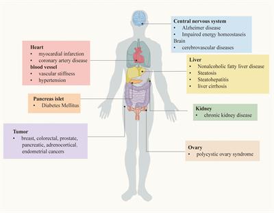 The crucial role and mechanism of insulin resistance in metabolic disease